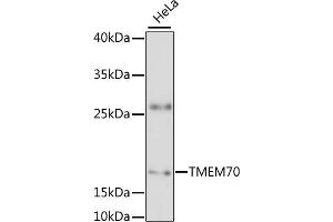 Western blot analysis of extracts of HeLa cells, using TMEM70 antibody (ABIN6133460, ABIN6149268, ABIN6149269 and ABIN6217808) at 1:3000 dilution. (Transmembrane Protein 70 (TMM70) (AA 161-260) Antikörper)