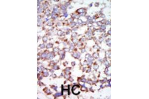 Immunohistochemistry (IHC) image for anti-Nuclear Receptor Subfamily 2, Group C, Member 2 (NR2C2) antibody (ABIN3003597) (TR4 Antikörper)