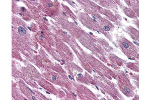 Immunohistochemistry (IHC) image for anti-Adenylate Cyclase Activating Polypeptide 1 (Pituitary) Receptor Type I (ADCYAP1R1) (N-Term) antibody (ABIN1048297)