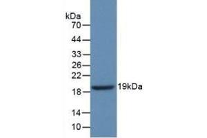Detection of Recombinant GbA, Human using Polyclonal Antibody to Glucocerebrosidase (GBA) (GBA Antikörper  (AA 334-498))