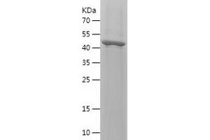 Western Blotting (WB) image for Fibroblast Growth Factor 13 (FGF13) (AA 10-245) protein (His-IF2DI Tag) (ABIN7122922) (FGF13 Protein (AA 10-245) (His-IF2DI Tag))