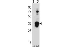 Western Blotting (WB) image for anti-U2 Small Nuclear RNA Auxiliary Factor 1 (U2AF1) antibody (ABIN3001638) (U2AF1 Antikörper)