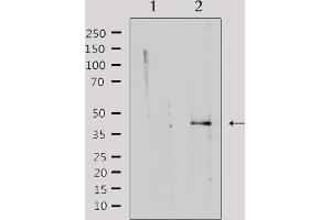 Western blot analysis of extracts from rat muscle, using KAPCG Antibody. (PRKACG Antikörper)