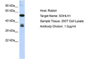 Host: Rabbit Target Name: SOHLH1 Sample Type: 293T Whole Cell lysates Antibody Dilution: 1. (SOHLH1 Antikörper  (C-Term))