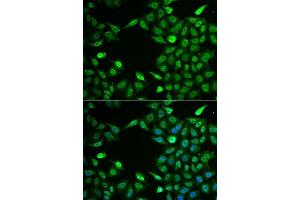 Immunofluorescence (IF) image for anti-Integrator Complex Subunit 6 (INTS6) (AA 1-280) antibody (ABIN6142494)