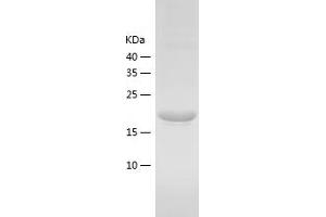 RAP2B Protein (AA 1-183) (His tag)