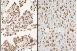 Immunohistochemistry (IHC) image for anti-Heterogeneous Nuclear Ribonucleoprotein K (HNRNPK) (AA 1-50) antibody (ABIN7454658) (HNRNPK Antikörper  (AA 1-50))