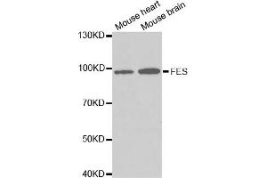Western Blotting (WB) image for anti-Feline Sarcoma Oncogene (FES) antibody (ABIN1872678) (FES Antikörper)