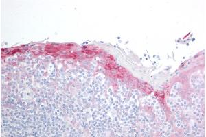 ABIN184852 (10µg/ml) staining of paraffin embedded Human Tonsil. (HSPB8 Antikörper  (C-Term))