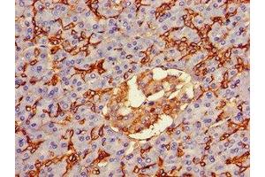 Immunohistochemistry of paraffin-embedded human pancreatic tissue using ABIN7144495 at dilution of 1:100 (Aquaporin 1 Antikörper  (AA 2-269))