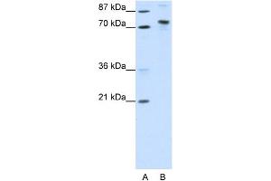 WB Suggested Anti-KIAA0737 Antibody Titration:  1. (TOX4 Antikörper  (N-Term))