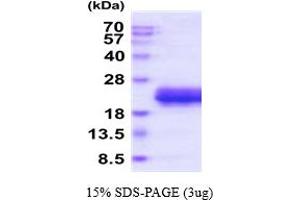 SDS-PAGE (SDS) image for Eosinophil Cationic Protein (ECP) (AA 28-160) protein (His tag) (ABIN5854791) (RNASE3 Protein (AA 28-160) (His tag))