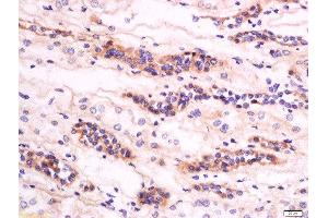 Formalin-fixed and paraffin embedded human kidney labeled with Anti-GM2A Polyclonal Antibody, Unconjugated  at 1:200 followed by conjugation to the secondary antibody and DAB staining