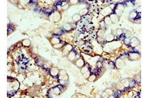 Immunohistochemistry of paraffin-embedded human small intestine tissue using ABIN7152503 at dilution of 1:100 (FBXW4 Antikörper  (AA 143-412))