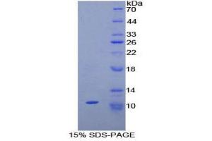 SDS-PAGE (SDS) image for Neuropeptide S (NPS) (AA 26-89) protein (His tag) (ABIN1879859)