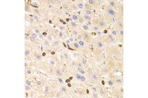 Immunohistochemistry of paraffin-embedded Human liver using LSP1 antibody at dilution of 1:100 (x400 lens). (LSP1 Antikörper)