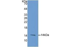 Detection of Recombinant ENG, Rat using Polyclonal Antibody to Endoglin (ENG) (Endoglin Antikörper  (AA 26-136))