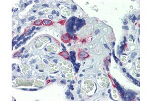 Human placenta; Anti-ZNF71 antibody IHC staining of human placenta. (ZNF71 Antikörper)