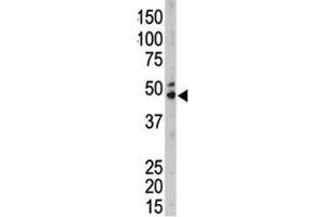 The SPHK1 antibody used in western blot to detect SPHK1 in mouse kidney tissue lysate (SPHK1 Antikörper  (AA 286-315))