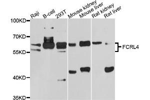Western blot analysis of extracts of various cell lines, using FCRL4 antibody (ABIN5997732) at 1/1000 dilution. (FCRL4 Antikörper)