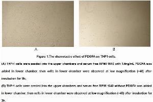 Image no. 3 for Platelet Derived Growth Factor A (PDGFA) (AA 94-194) (Active) protein (His tag) (ABIN5665894) (PDGFA Protein (AA 94-194) (His tag))