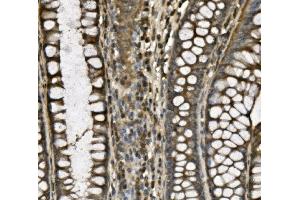 IHC analysis of CD239/BCAM using anti-CD239/BCAM antibody (ABIN7602976).