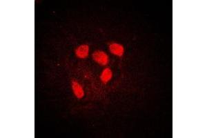 Immunofluorescent analysis of c-Myc (pS62) staining in HeLa cells.
