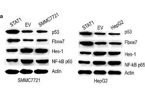 Effect of STAT1 on p53, Fbxw7, Hes-1 and NF-κB p65.