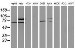 Image no. 2 for anti-SAM Domain and HD Domain 1 (SAMHD1) antibody (ABIN1500801) (SAMHD1 Antikörper)