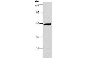 Western Blot analysis of Hela cell using DRD1 Polyclonal Antibody at dilution of 1:1000 (Dopamine Receptor d1 Antikörper)