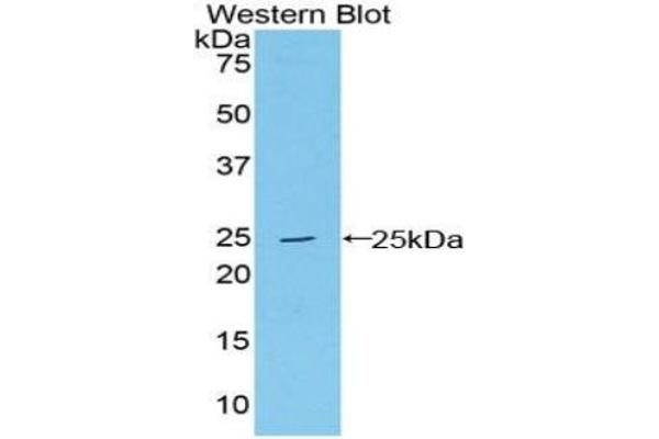 PSMB8 Antikörper  (AA 75-261)