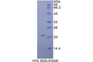 SDS-PAGE analysis of Mouse HDGF Protein. (HDGF Protein)