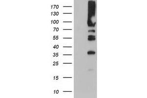 Western Blotting (WB) image for anti-phosphofructokinase, Platelet (PFKP) antibody (ABIN1500161) (PFKP Antikörper)
