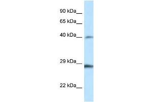 WB Suggested Anti-Hoxb9 Antibody Titration: 1. (HOXB9 Antikörper  (Middle Region))