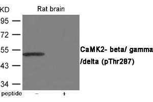 Western blot analysis of extracts from Rat brain using CaMK2- beta/ gamma/ delta (Phospho-Thr287) Antibody. (CAMK2D Antikörper  (pThr287))