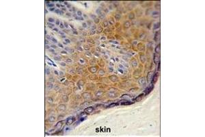 Formalin-fixed and paraffin-embedded human skin reacted with DERA Antibody (N-term), which was peroxidase-conjugated to the secondary antibody, followed by DAB staining. (DERA Antikörper  (N-Term))