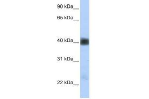 SGCB antibody used at 1 ug/ml to detect target protein. (SGCB Antikörper)