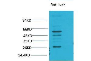 Western Blot (WB) analysis of Rat LiverTissue using TGFbeta1 Polyclonal Antibody. (TGFB1 Antikörper)