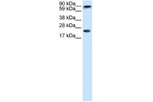 WB Suggested Anti-CBX5 Antibody Titration:  1. (CBX5 Antikörper  (Middle Region))