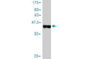 Western Blot detection against Immunogen (38. (MAPK12 Antikörper  (AA 251-367))