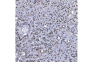 IHC analysis of SF3B3 using anti-SF3B3 antibody (ABIN7602378).