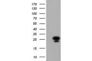 Western Blotting (WB) image for anti-Adenylate Kinase 3 (AK3) antibody (ABIN1496523)