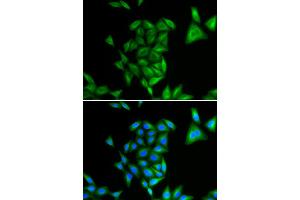 Immunofluorescence (IF) image for anti-Phytanoyl-CoA 2-Hydroxylase (PHYH) antibody (ABIN1980320) (PHYH Antikörper)