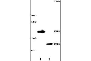 Lane 1: rat brain lysates Lane 2: rat lung lysates probed with Anti ADCY5 Polyclonal Antibody, unconjugated (ABIN751183) at 1:200 in 4 °C Followed by conjugation to secondary antibody (ABIN727474-HRP) at 1:3000 90min in 37 °C Predicted band 139kD. (ADCY5 Antikörper  (AA 857-909))