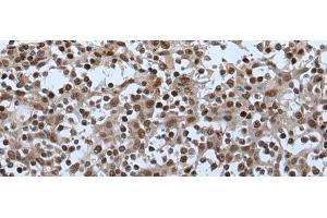 Immunohistochemistry of paraffin-embedded Human tonsil tissue using CELF5 Polyclonal Antibody at dilution of 1:65(x200) (CELF5 Antikörper)