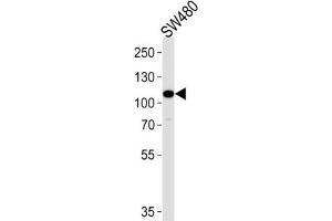 Western Blotting (WB) image for anti-Mitogen-Activated Protein Kinase Kinase Kinase 9 (MAP3K9) antibody (ABIN3003606) (MAP3K9 Antikörper)