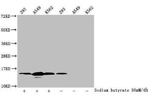 Western Blot Detected samples: 293 whole cell lysate, A549 whole cell lysate, K562 whole cell lysate, Untreated (-) or treated (+) with 30 mM sodium butyrate for 4h All lanes: HIST1H2BC antibody at 1:100 Secondary Goat polyclonal to rabbit IgG at 1/50000 dilution Predicted band size: 14 kDa Observed band size: 14 kDa (Histone H2B Antikörper  (acLys12))