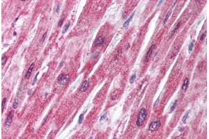 Human Heart (formalin-fixed, paraffin-embedded) stained with TRAF2 antibody ABIN214009 at 5 ug/ml followed by biotinylated goat anti-rabbit IgG secondary antibody ABIN481713, alkaline phosphatase-streptavidin and chromogen. (TRAF2 Antikörper  (N-Term))