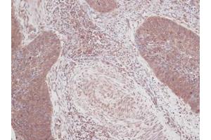 Image no. 1 for anti-Colony Stimulating Factor 2 (Granulocyte-Macrophage) (CSF2) antibody (ABIN465582) (GM-CSF Antikörper)