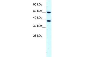 WB Suggested Anti-RORA Antibody Titration:  4. (RORA Antikörper  (N-Term))